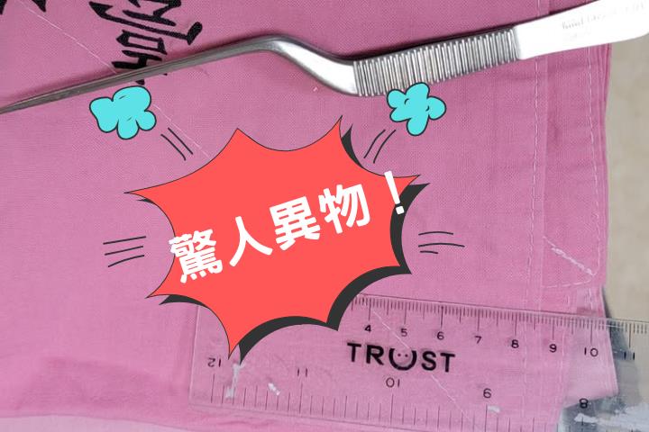 70歲伯感冒鼻塞狂吸不通！醫一吸竟拖出「恐怖異物」本人都傻眼