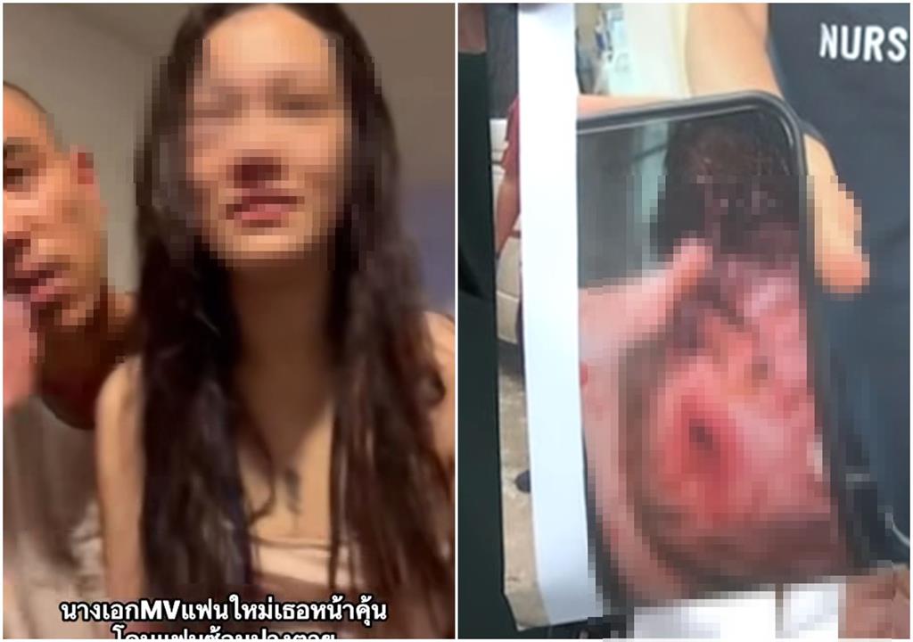 有片／女星遭警二代前男友家暴！腫成豬頭還噴血　恐怖囚禁畫面曝光