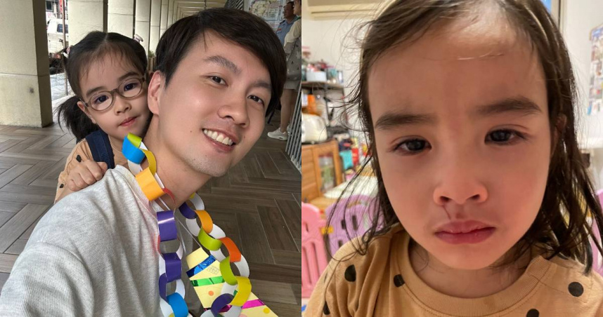 男星4歲愛女「嘴巴遭椅子撞傷」 心疼發文求助:需要看哪一科?