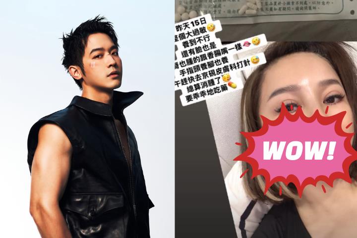 王彩樺「嘴唇腫成香腸」真相曝!現身惹「整形疑雲」她親上火線回應