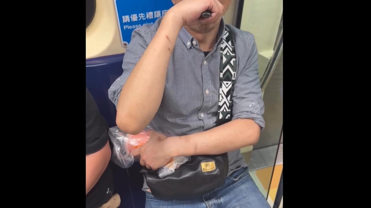 北捷車廂高調抽電子煙　正義乘客勸阻反被吐煙在臉上