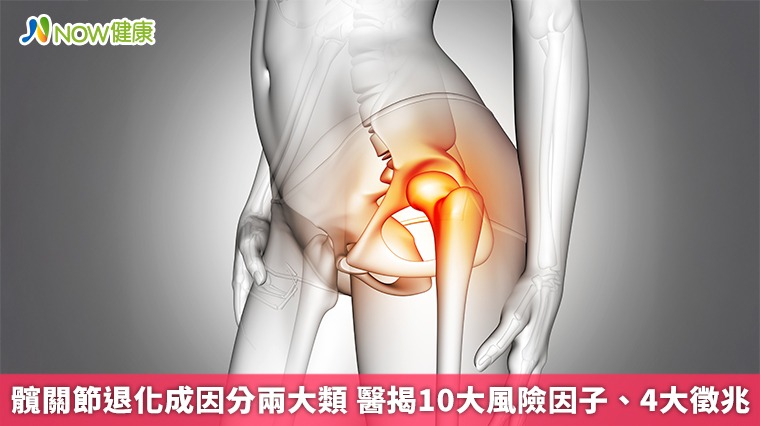 髖關節退化成因分兩大類 醫揭10大風險因子、4大徵兆