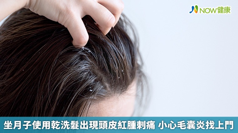 坐月子使用乾洗髮出現頭皮紅腫刺痛　小心毛囊炎找上門