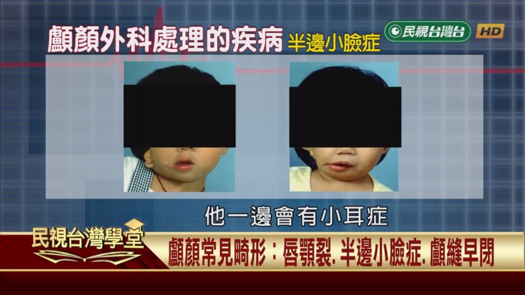 臉部畸形有救了!透過整形顯微重建修復手術 還你美麗臉蛋