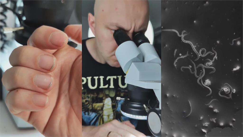 停止咬指甲！科學家用顯微鏡放大指甲垢　驚見「蠕動生物」網崩：要吐了