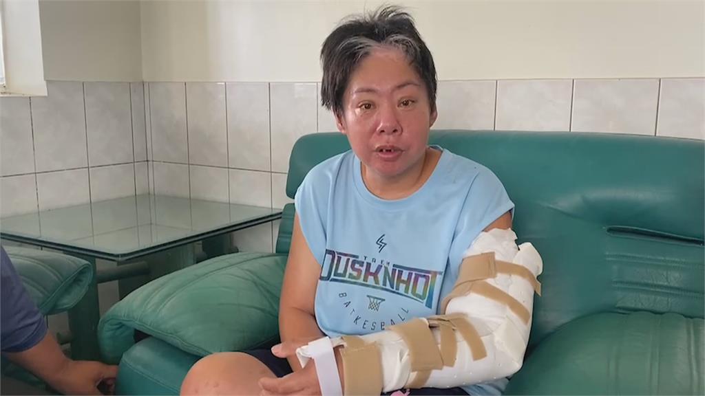 台南37歲女遇工安斷臂　雇主沒幫保勞保！換藥都是負擔