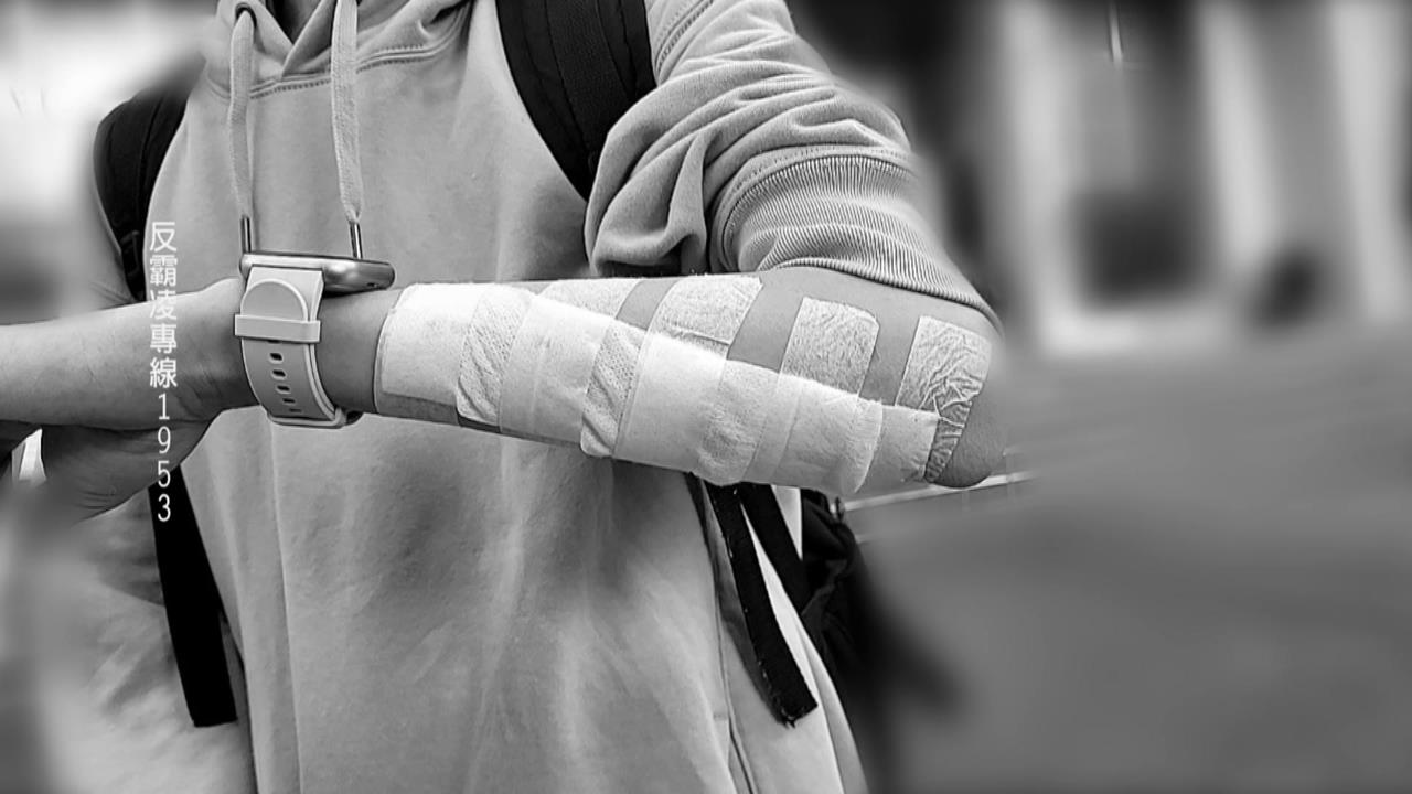 北市某國中傳霸凌！　家長控兒遭同學過肩摔「留13公分傷痕」怒提告