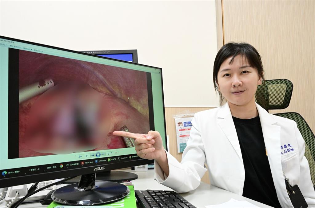 男車禍狂輸血卻血紅素掉不停   竟罕見「肝水泡」破裂