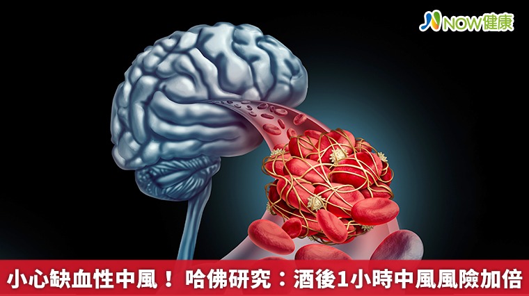 小心缺血性中風！哈佛研究：酒後1小時中風風險加倍