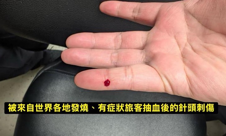 快新聞／誇張！機場檢疫人員遭同事亂丟針頭刺傷恐染病「請假卻被刁難」　疾管署回應了