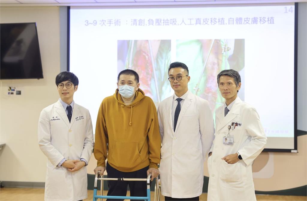 單親爸車禍「雙腳幾截斷…」   新光醫院奇蹟115天成功保肢