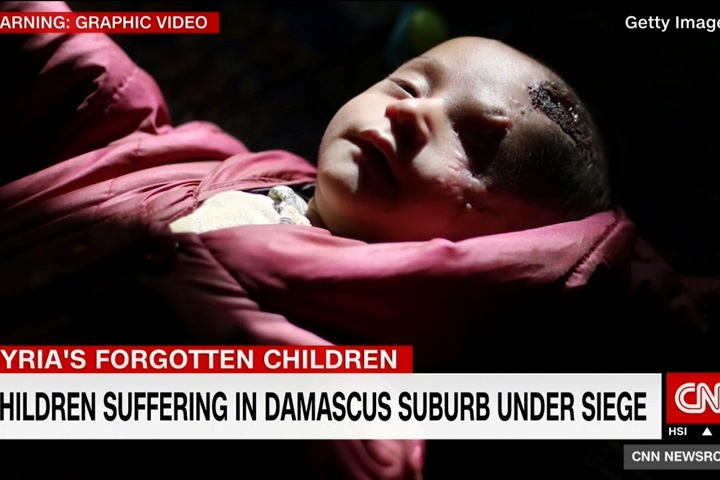 敘利亞戰火未歇 2個月獨眼嬰兒照撼人心