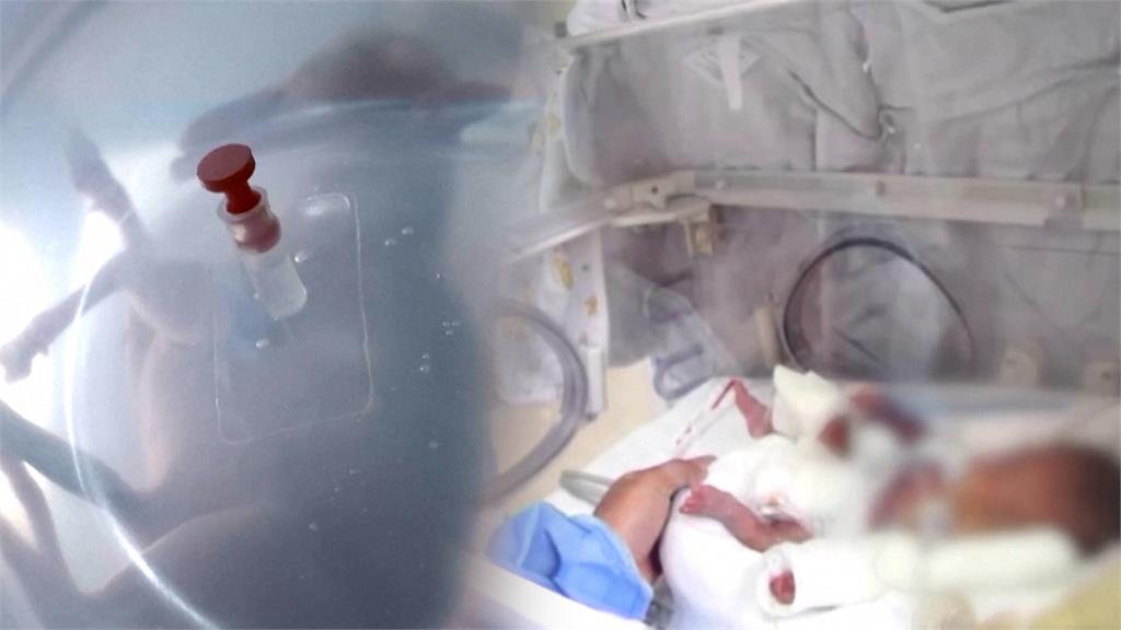 人造子宮拯救「極度早產兒」　羔羊胚胎成功存活天數曝光