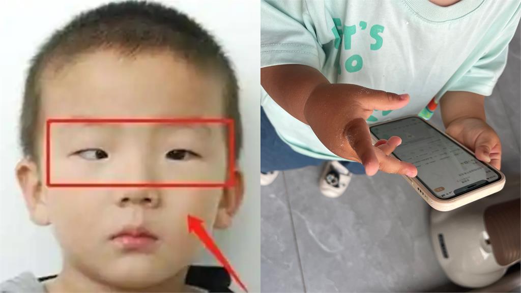 5歲男童狂玩手機⋯家長驚見「黑眼珠消失」！醫示警1事：恢復可能性很低