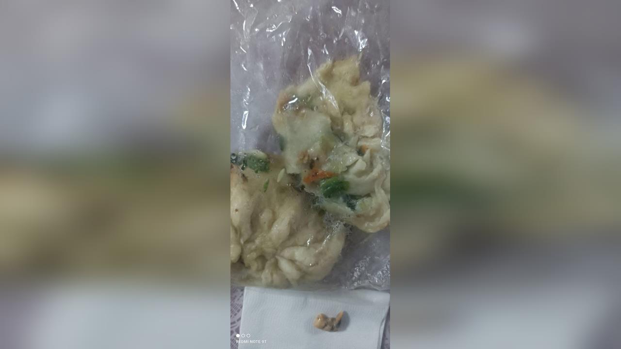 快新聞／人肉水煎包？民眾一咬內餡驚見「牙齒」　台東衛生局回應了