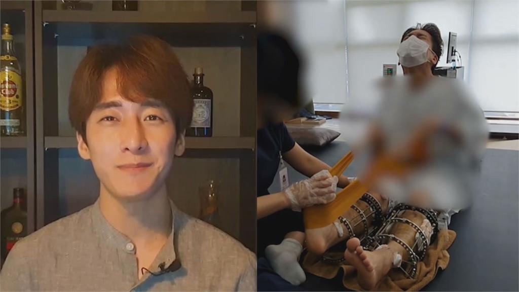 160cm被甩15次！34歲韓男挑戰「斷骨增高」手術　1年後增7公分超勵志