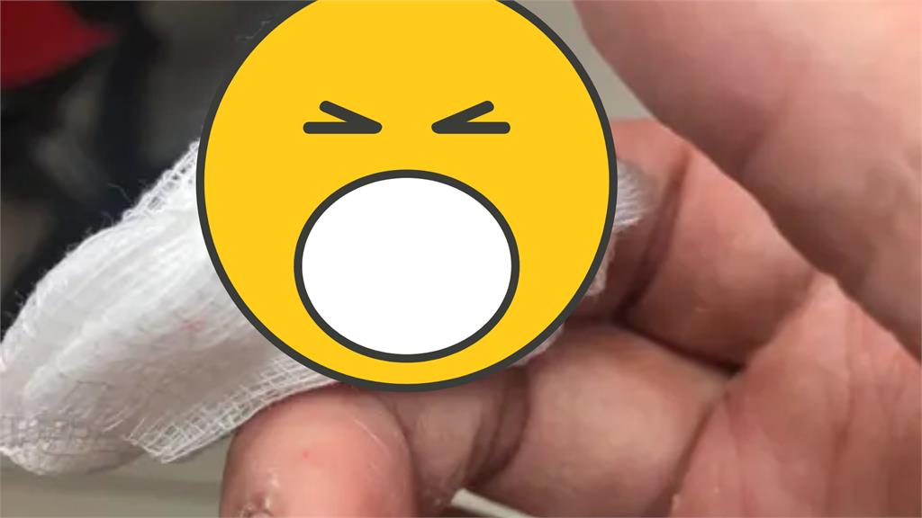 頭髮不慎插進手指！才拖4天…傷口竟化膿「需強行拔出」：痛到快往生