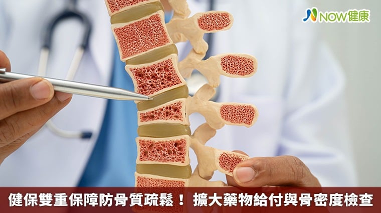 健保雙重保障防骨質疏鬆！ 擴大藥物給付與骨密度檢查