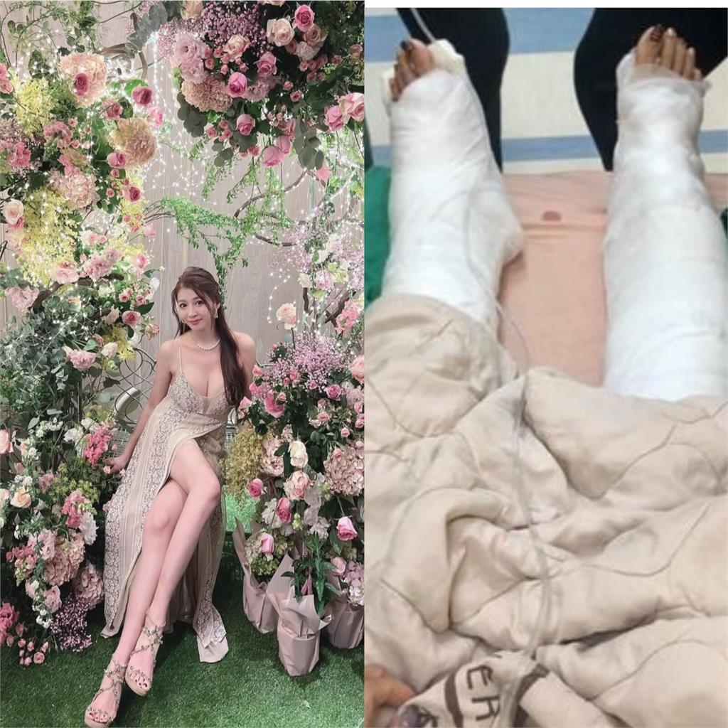 「最美禮生」搭艇出海翻船美腿遭捲螺旋槳　船長挨告最終結果出爐