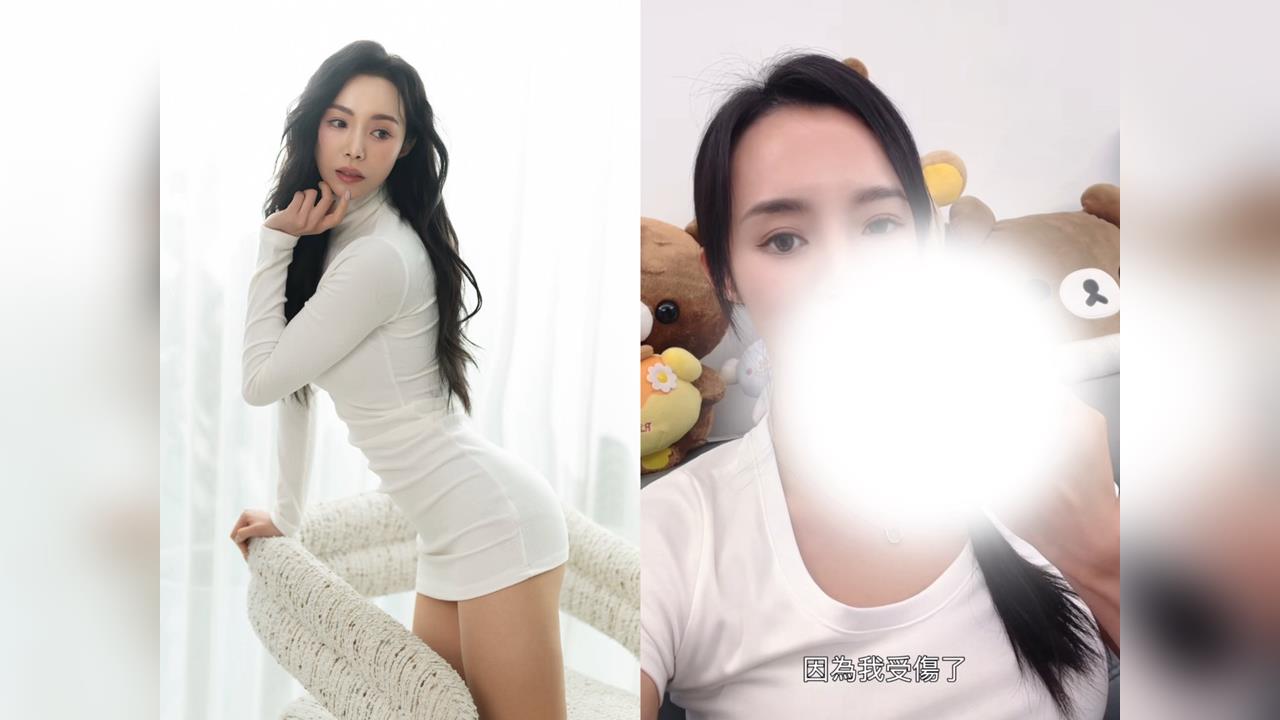 舞蹈女神驚傳手指「爆開」！茵茵自曝送急診縫3針　急宣頻道停更2周