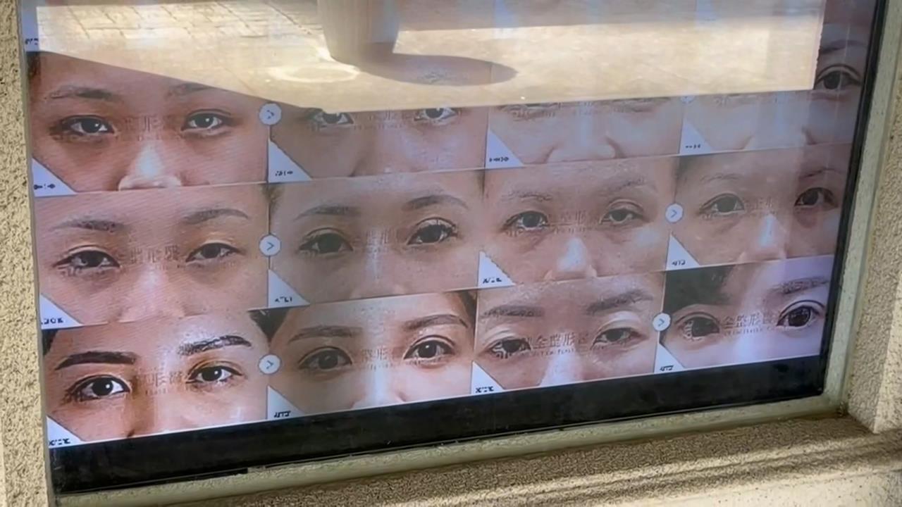 割眼袋喪命！45歲女麻醉後昏迷　送醫驚見胃穿孔急救11天亡