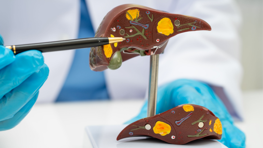 台灣脂肪肝人口超過3成！治療希望竟是 「瘦瘦筆」？ 醫證實：有望改善肝纖維化