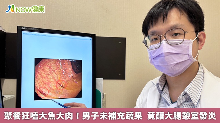 聚餐狂嗑大魚大肉！男子未補充蔬果　竟釀大腸憩室發炎
