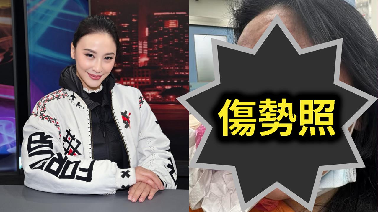 安歆澐突發不自殺聲明！公開遭尪勒脖「血管大爆裂」傷勢照：還是擔心被傷害