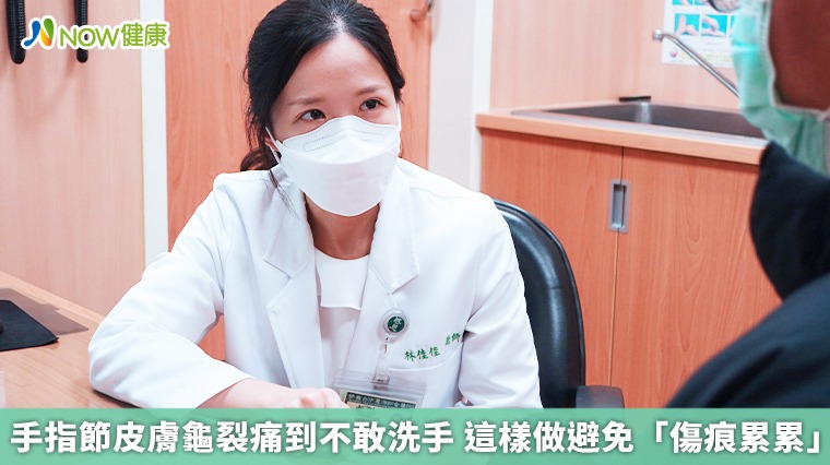 手指節皮膚龜裂痛到不敢洗手　這樣做避免「傷痕累累」