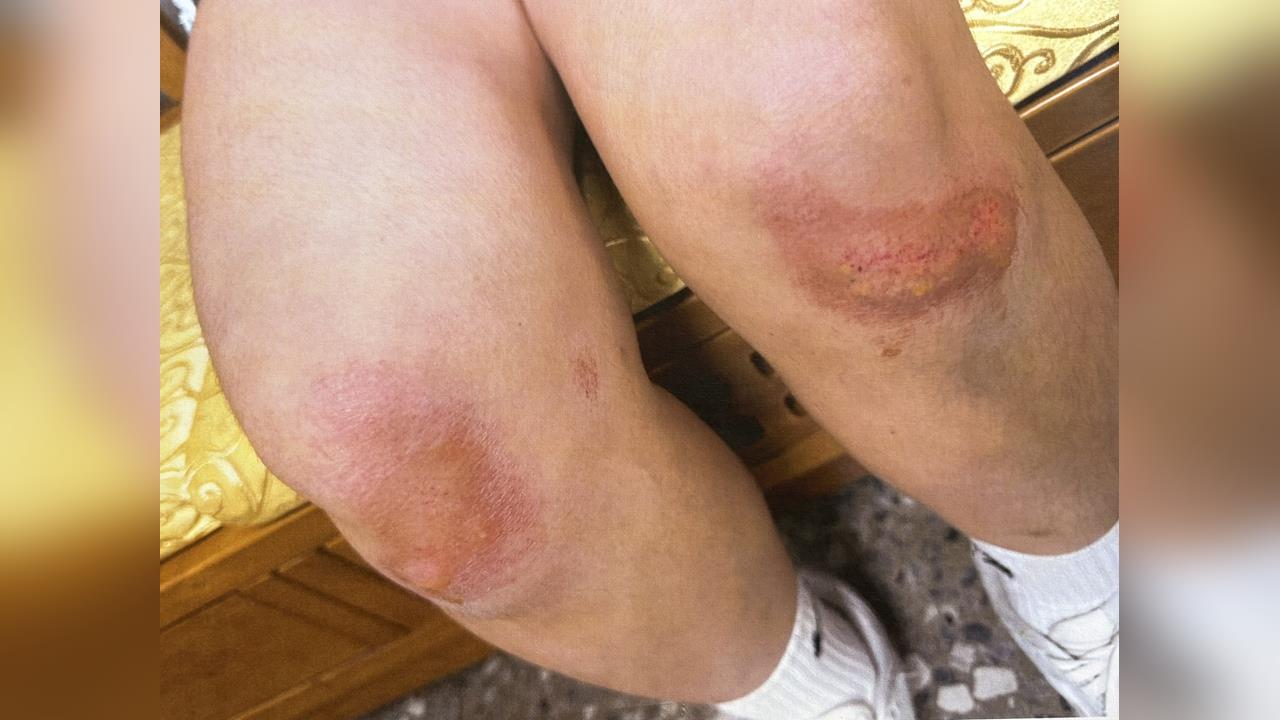 台中少女與堂姊觀影「滑手機交談」　引鄰座男不滿遭拖行毆打、賞耳光