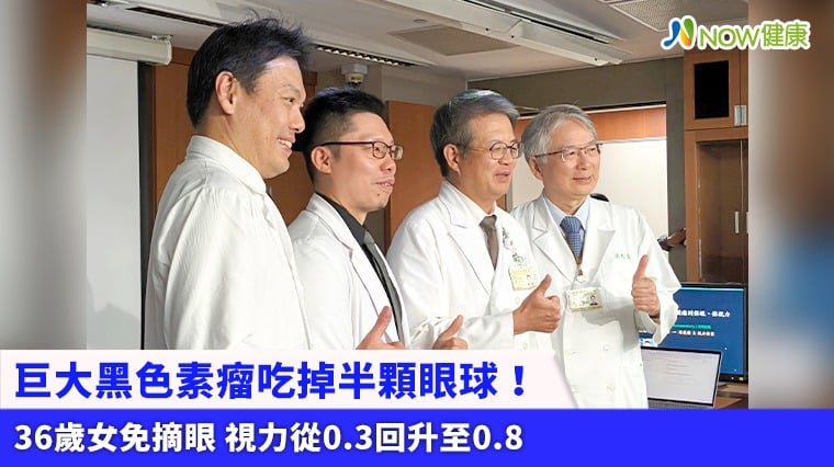 巨大黑色素瘤吃掉半顆眼球!36歲女免摘眼 視力從0.3回升至0.8