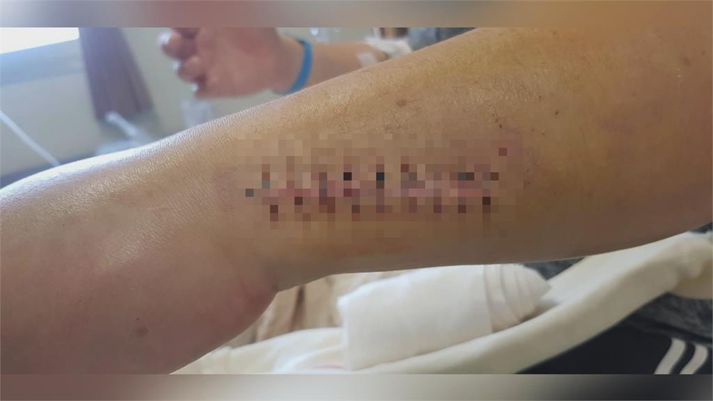 車禍術後問病況 院方:去台南問開刀醫師