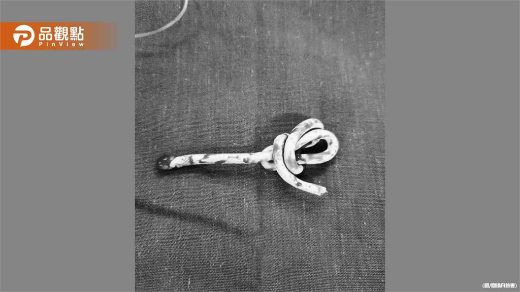 15歲少年模仿網路挑戰！35公分網路線塞尿道卡住痛爆