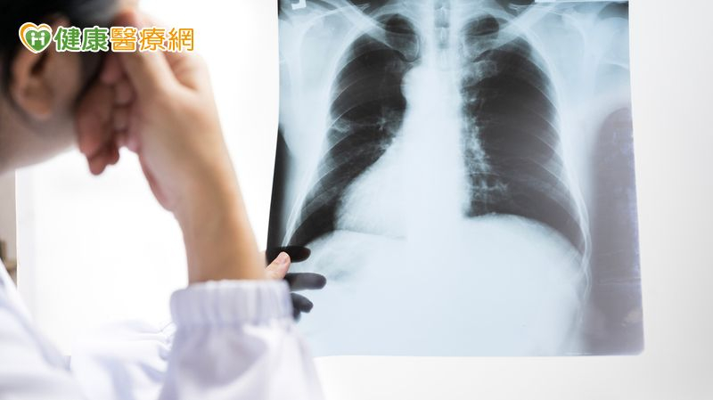 家庭主婦健檢意外發現肺腺癌　醫揭「救命１關鍵」：非常重要