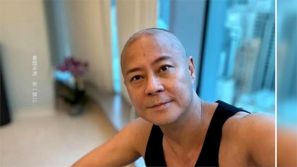 草蜢蔡一傑「切除腦部腫瘤」　PO出後腦勺照曝長長開刀痕