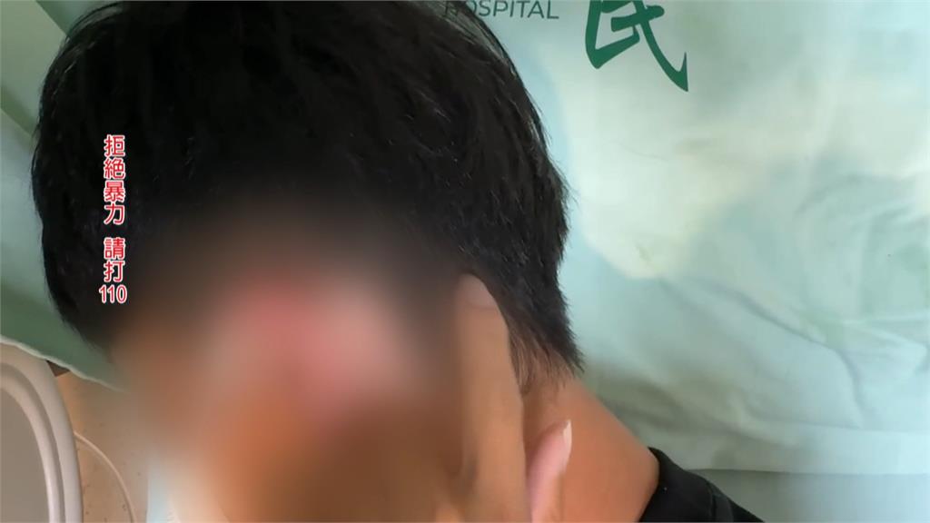 南投草屯在車庫熱車被嫌吵　鄰居持棒球棍K男子頭　一度命危
