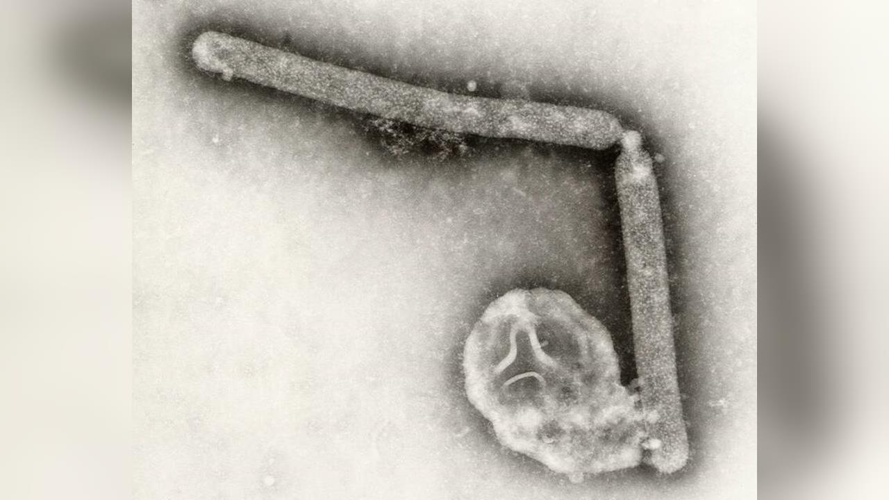 快新聞／美國爆H5N5禽流感全球首例人類死亡　疾管署：列第一級旅遊警示