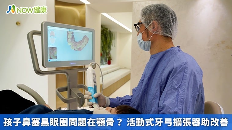 孩子鼻塞黑眼圈問題在顎骨？ 活動式牙弓擴張器助改善