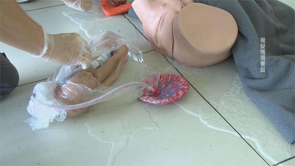 機率8萬分之1「人魚寶寶」　救護員剪破羊膜女嬰蹦出