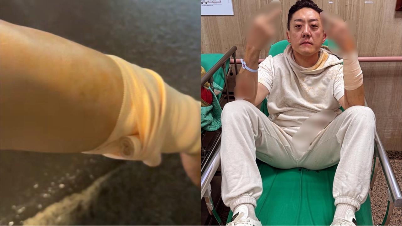 快新聞/遭埋伏砍殺!「夜店大亨」夏天倫濺血 深夜吐心聲:為朋友擋一刀