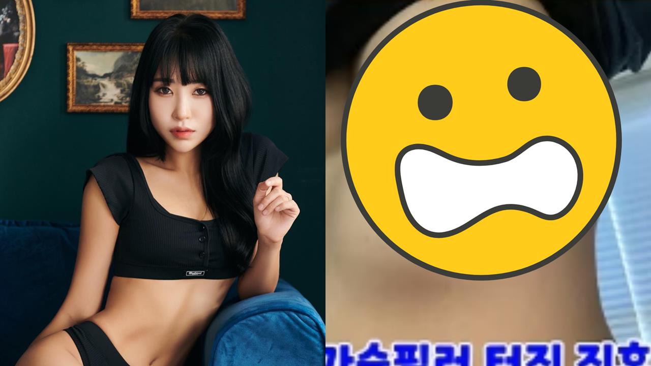 女星砸千萬隆乳慘變惡夢！填充物下垂到肋骨變「4個胸部」畫面首度公開