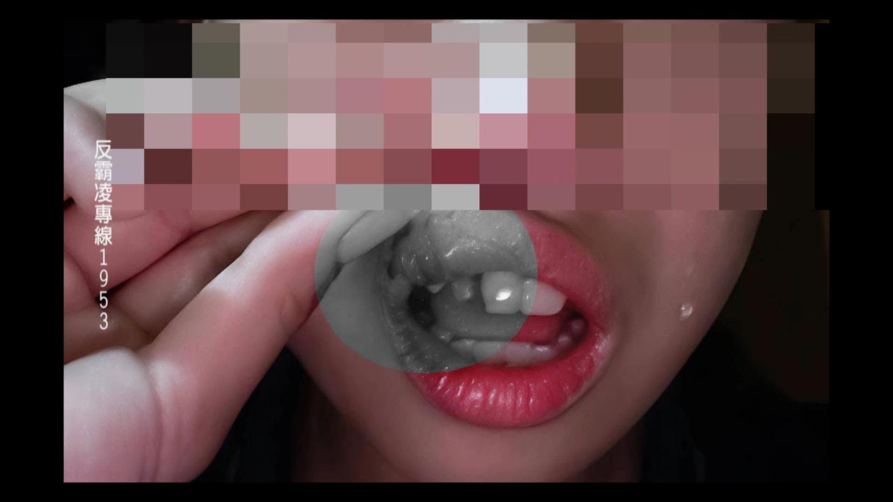 長期遭男同學性騷霸凌！　拳擊國手少女國中會考被打斷牙