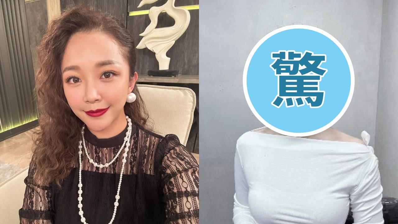 賴慧如才暫別八點檔!無預警宣布幹大事「親自往頭動刀」瞬間回春重返18歲