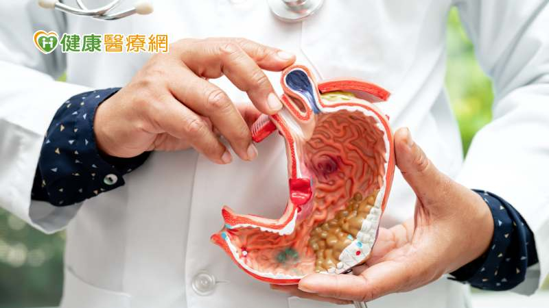胃癌約9成是「幽門桿菌」所致！護胃健康有5招　今年篩檢擴大試辦17縣市