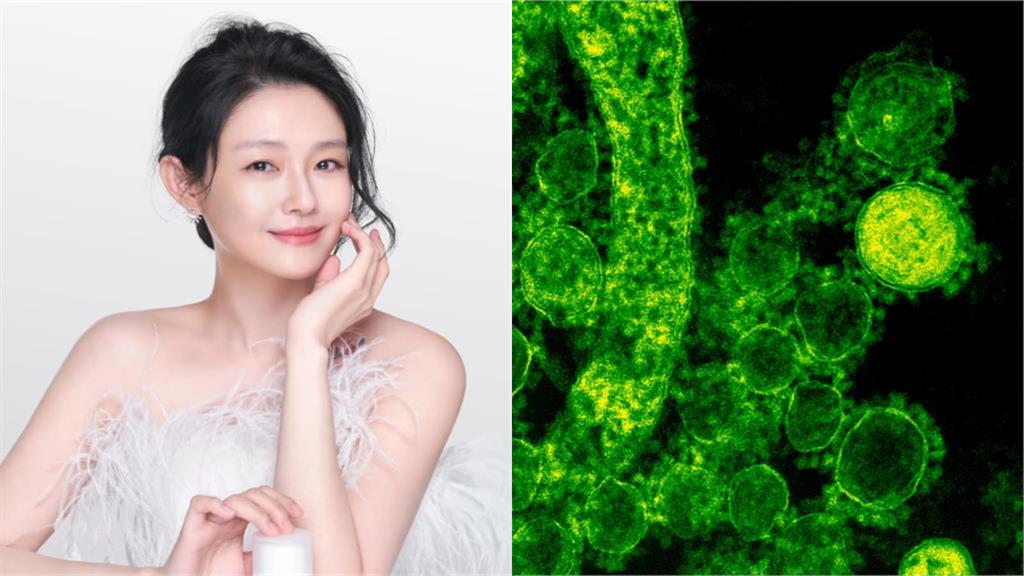 大S傳不是死於肺炎!知情人士揭「真正死因」醫師說話了:一點都不奇怪