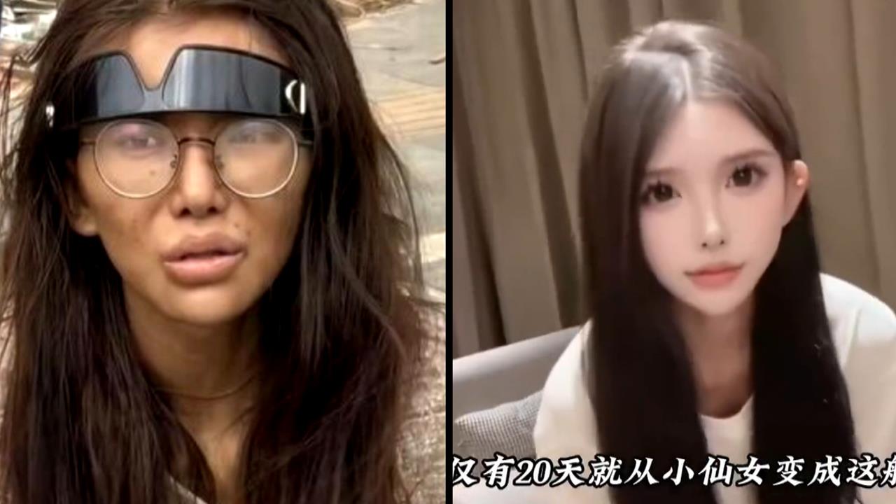 被男友騙至柬埔寨! 中國網紅雙腿疑骨折被丟路邊