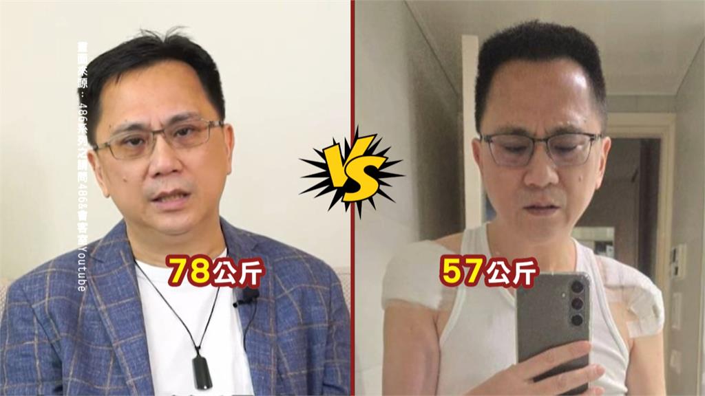 486先生健康亮紅燈　糖尿病+肩膀沾黏「爆瘦21公斤」