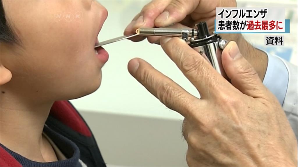 日本流感疫情失控！單週222萬患者創紀錄