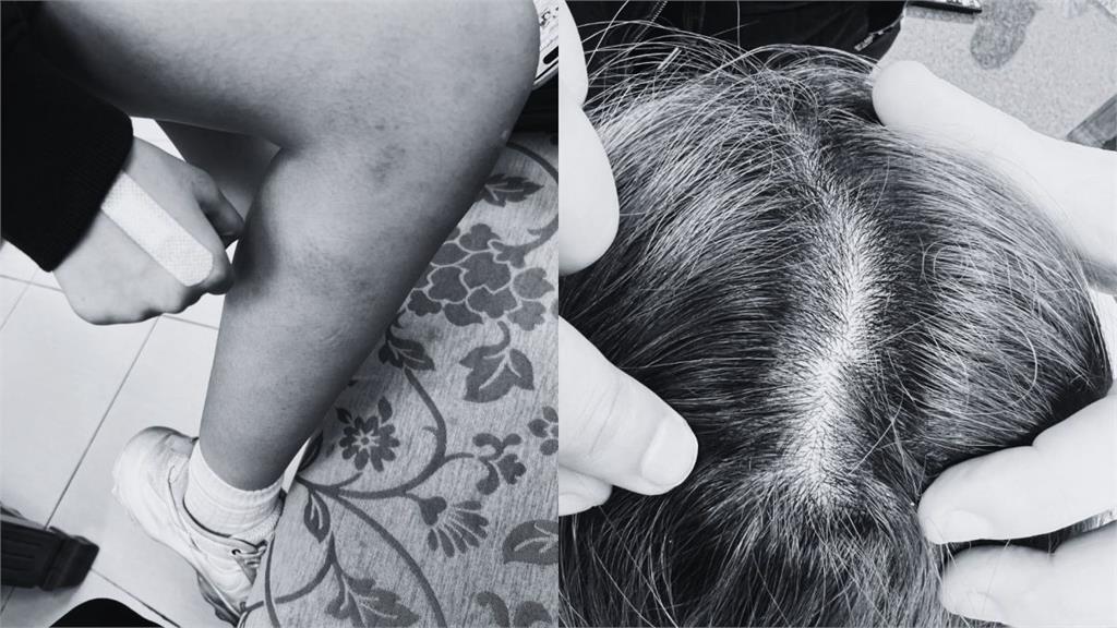 學妹遭學長拖行剪髮！家長冷回「他有憂鬱症多體諒」　網炸了