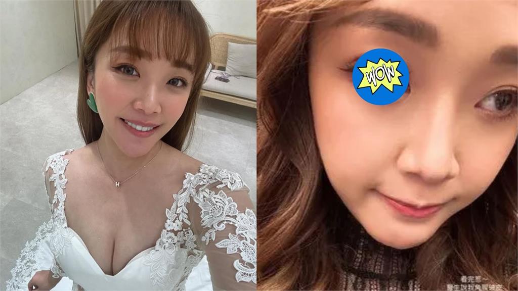 賴慧如婚前眼睛突變「血紅色」粉絲全嚇壞！她嘆：都是因為「麗美」太愛哭